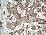 UQCRH Antibody in Immunohistochemistry (Paraffin) (IHC (P))
