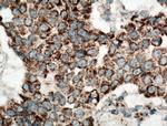 UQCRH Antibody in Immunohistochemistry (Paraffin) (IHC (P))
