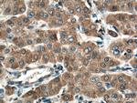 Cytochrome b5 Antibody in Immunohistochemistry (Paraffin) (IHC (P))