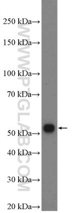 TSKU Antibody in Western Blot (WB)