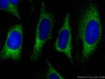 SNX12 Antibody in Immunocytochemistry (ICC/IF)