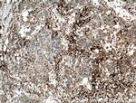 PD-ECGF Antibody in Immunohistochemistry (Paraffin) (IHC (P))