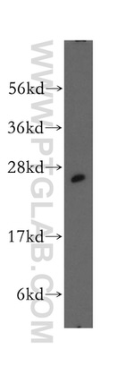 UCHL3 Antibody in Western Blot (WB)
