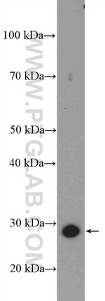 UCHL3 Antibody in Western Blot (WB)