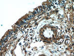 UBAP1 Antibody in Immunohistochemistry (Paraffin) (IHC (P))