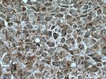 UBAP1 Antibody in Immunohistochemistry (Paraffin) (IHC (P))
