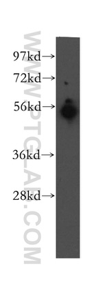 UBAP1 Antibody in Western Blot (WB)