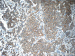 RAF1 Antibody in Immunohistochemistry (Paraffin) (IHC (P))