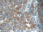 RAF1 Antibody in Immunohistochemistry (Paraffin) (IHC (P))