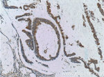 RAF1 Antibody in Immunohistochemistry (Paraffin) (IHC (P))