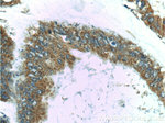 RAF1 Antibody in Immunohistochemistry (Paraffin) (IHC (P))