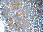 RAF1 Antibody in Immunohistochemistry (Paraffin) (IHC (P))