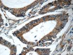 RAF1 Antibody in Immunohistochemistry (Paraffin) (IHC (P))