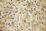 BEX1/2 Antibody in Immunohistochemistry (Paraffin) (IHC (P))