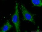 A4GALT Antibody in Immunocytochemistry (ICC/IF)