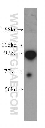 COPG Antibody in Western Blot (WB)