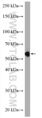LBR Antibody in Western Blot (WB)