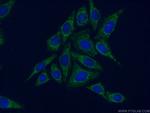 HGSNAT Antibody in Immunocytochemistry (ICC/IF)