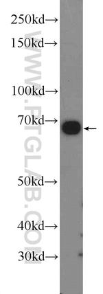 HGSNAT Antibody in Western Blot (WB)