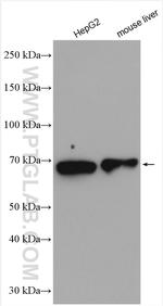 HGSNAT Antibody in Western Blot (WB)