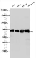 HGSNAT Antibody in Western Blot (WB)