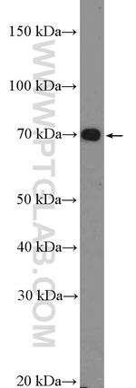 HGSNAT Antibody in Western Blot (WB)