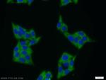 MAGEB1 Antibody in Immunocytochemistry (ICC/IF)