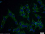MAGEB1 Antibody in Immunocytochemistry (ICC/IF)