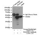 MAGEB1 Antibody in Immunoprecipitation (IP)