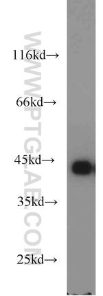 MAGEB1 Antibody in Western Blot (WB)