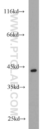 MAGEB1 Antibody in Western Blot (WB)