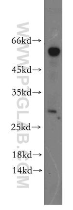 SSX5 Antibody in Western Blot (WB)