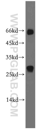 SSX5 Antibody in Western Blot (WB)
