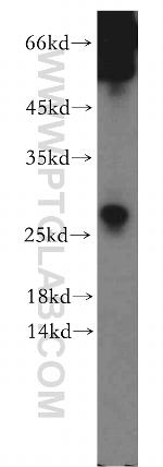 SSX5 Antibody in Western Blot (WB)