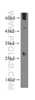SSX5 Antibody in Western Blot (WB)