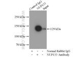 NUP133 Antibody in Immunoprecipitation (IP)