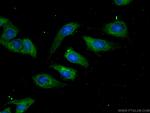 Aconitase 1 Antibody in Immunocytochemistry (ICC/IF)