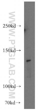 GEMIN4 Antibody in Western Blot (WB)