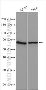 APPBP2 Antibody in Western Blot (WB)