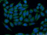 GSTM1 Antibody in Immunocytochemistry (ICC/IF)