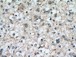 GSTM1 Antibody in Immunohistochemistry (Paraffin) (IHC (P))