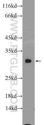 GSTM1 Antibody in Western Blot (WB)