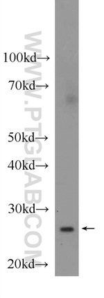 GSTM1 Antibody in Western Blot (WB)