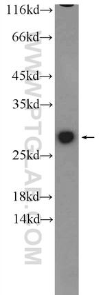 GSTM1 Antibody in Western Blot (WB)