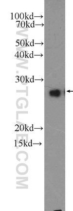 GSTM1 Antibody in Western Blot (WB)