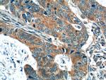 OSBPL3 Antibody in Immunohistochemistry (Paraffin) (IHC (P))