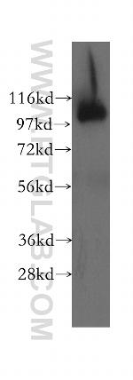 OSBPL3 Antibody in Western Blot (WB)