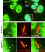BBS10 Antibody in Immunocytochemistry (ICC/IF)