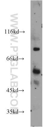 BBS10 Antibody in Western Blot (WB)