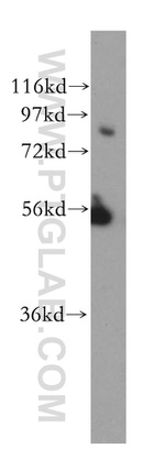 BBS10 Antibody in Western Blot (WB)